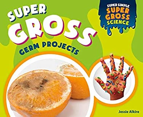 Super Gross Germ Projects Library Binding Jessie Alkire