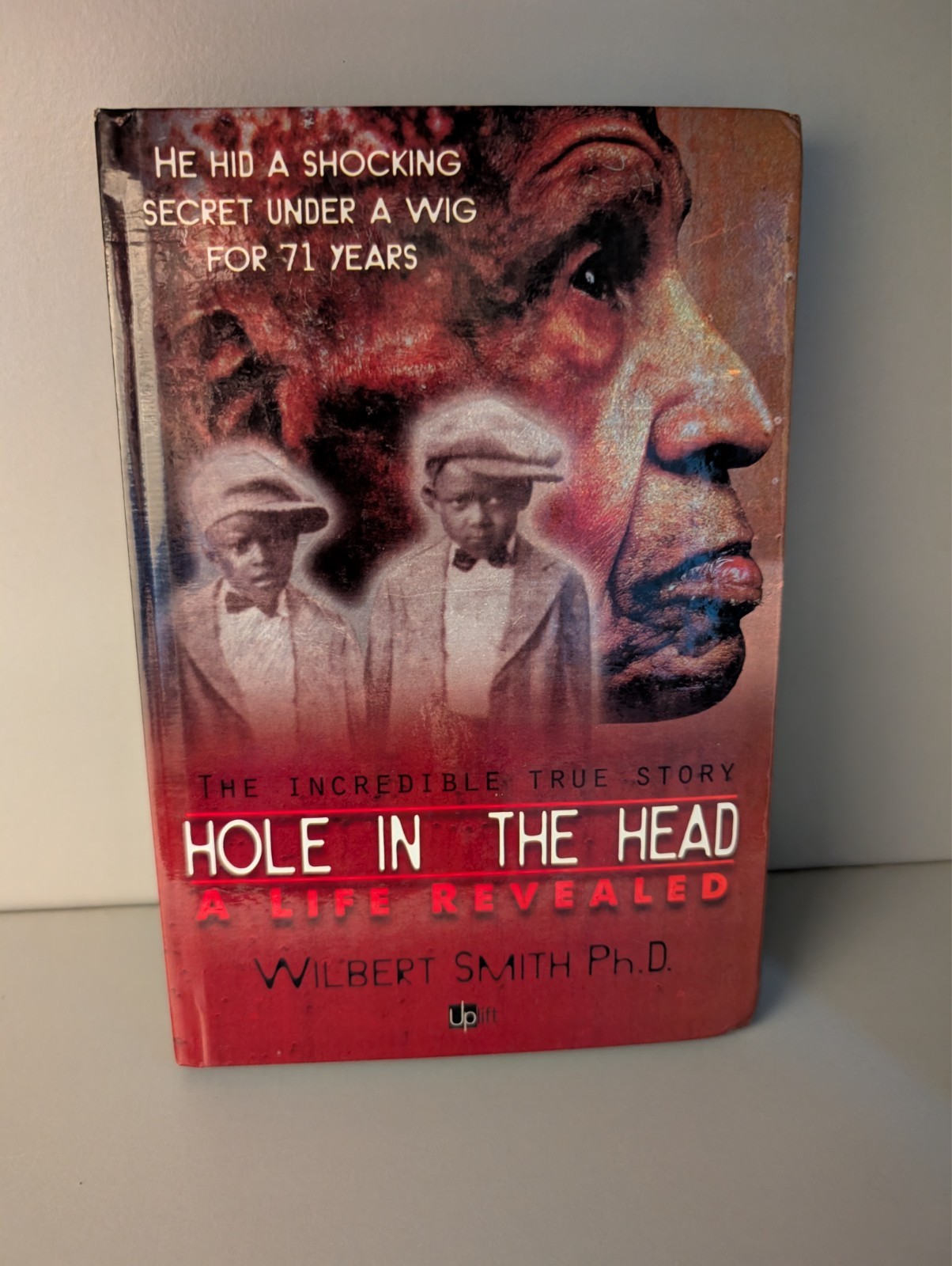 A Hole in the Head: A life Revealed By Wilbert Smith